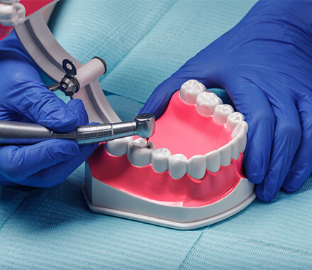 M.D.S. - CONSERVATIVE DENTISTRY AND ENDODONTICS
